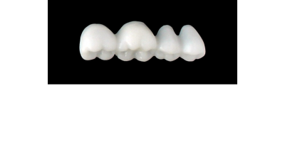 Cod.S1LOWER LEFT : 15x  posterior solid (not hollow) wax bridges, LARGE , (37-34) , with precarved occlusion to Cod.S1UPPER LEFT,and compatible to Cod.E1LOWER LEFT (hollow), (37-34)